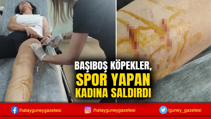 BAŞIBOŞ KÖPEKLER, SPOR YAPAN KADINA SALDIRDI