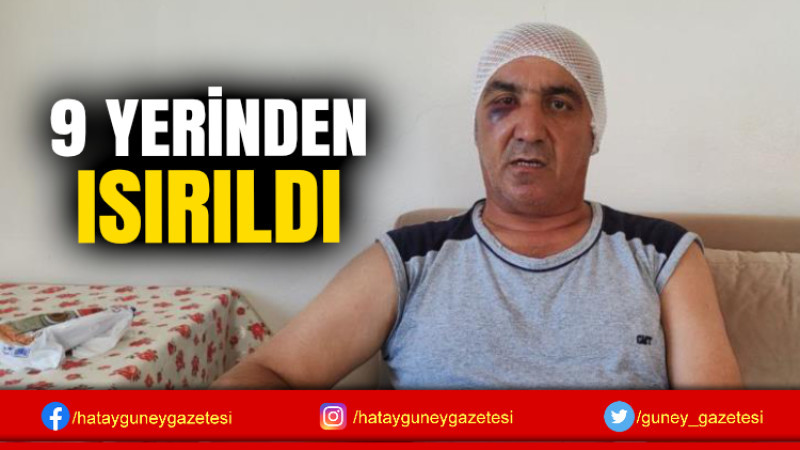 9 YERİNDEN ISIRILDI